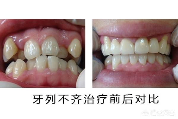 文山最新24小时牙医在线咨询方法分析(最方便真实的文山有没有24小时牙医方法)